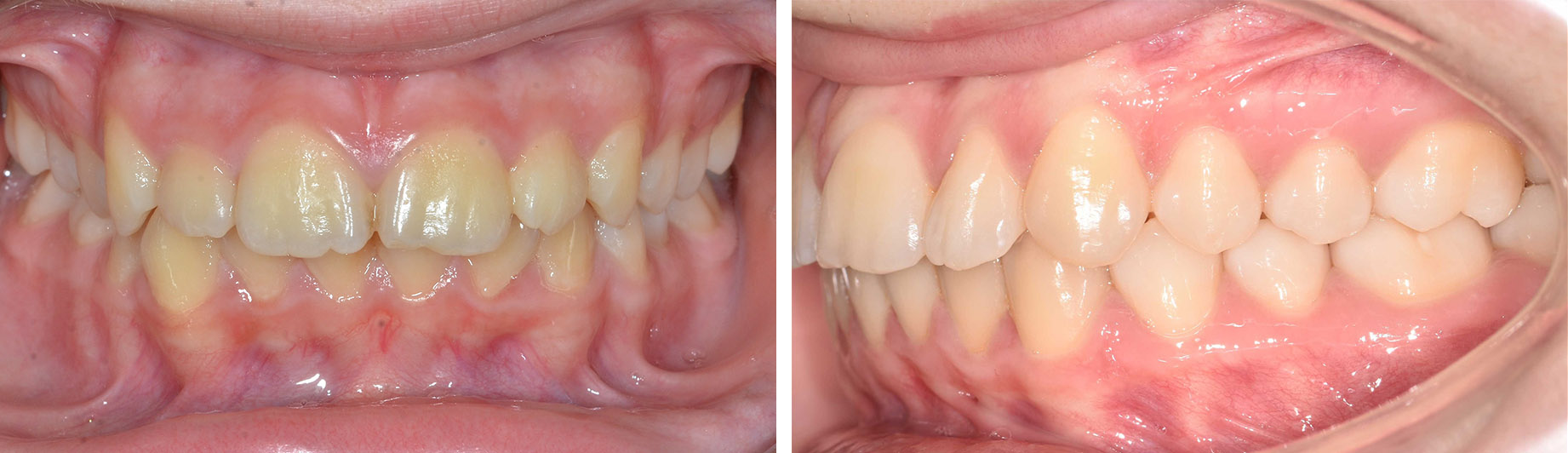Schimbarea pacientului după tratamentul realizat de Clinica Dr. Barbu