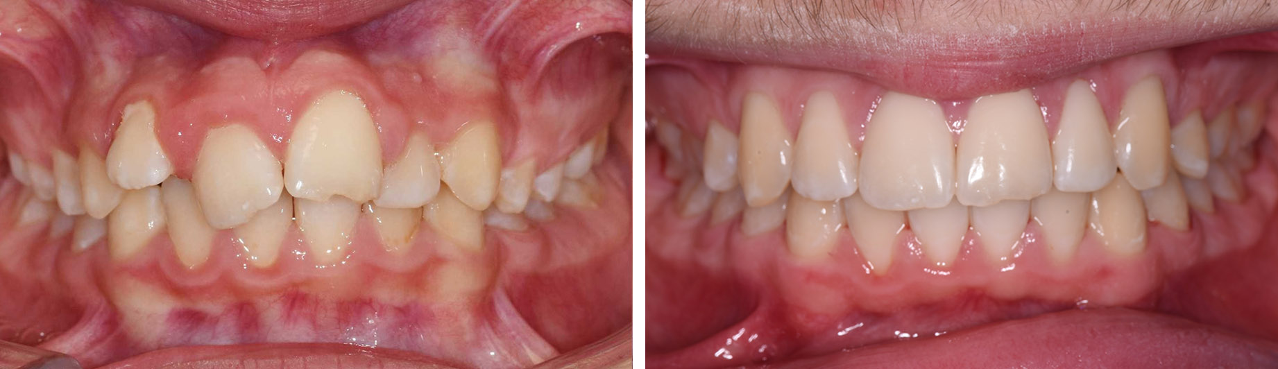 Schimbarea pacientului după tratamentul realizat de Clinica Dr. Barbu