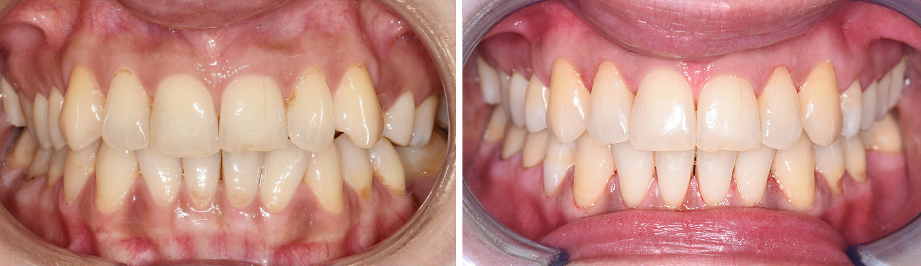 Schimbarea pacientului după tratamentul realizat de Clinica Dr. Barbu