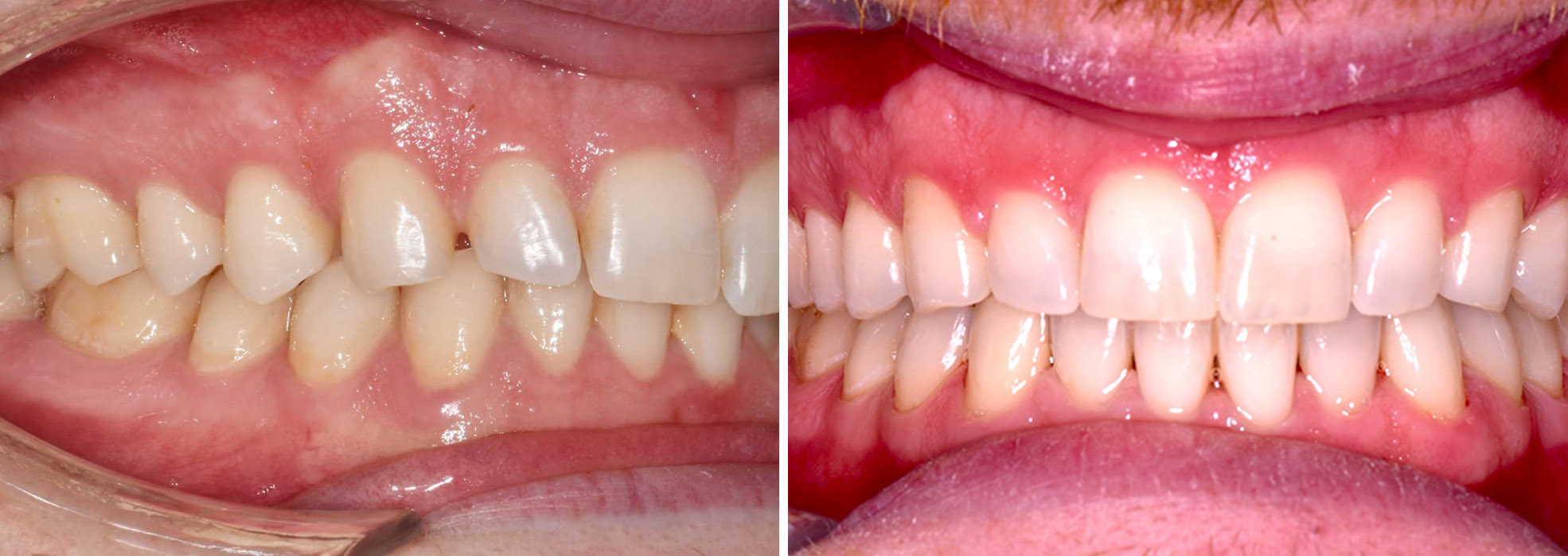 Schimbarea pacientului după tratamentul realizat de Clinica Dr. Barbu