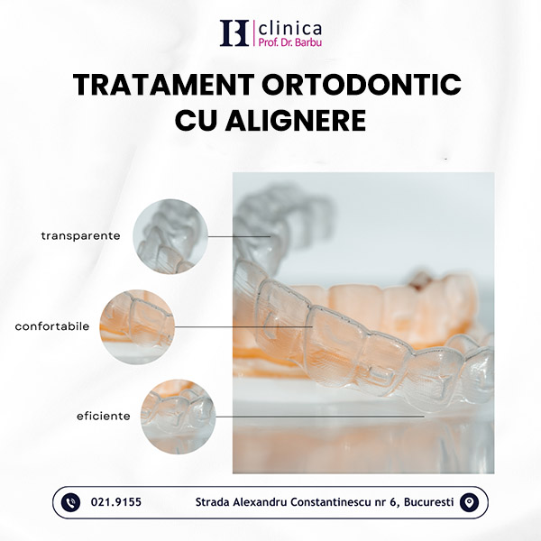 Etapele tratamentului ortodontic cu alignere